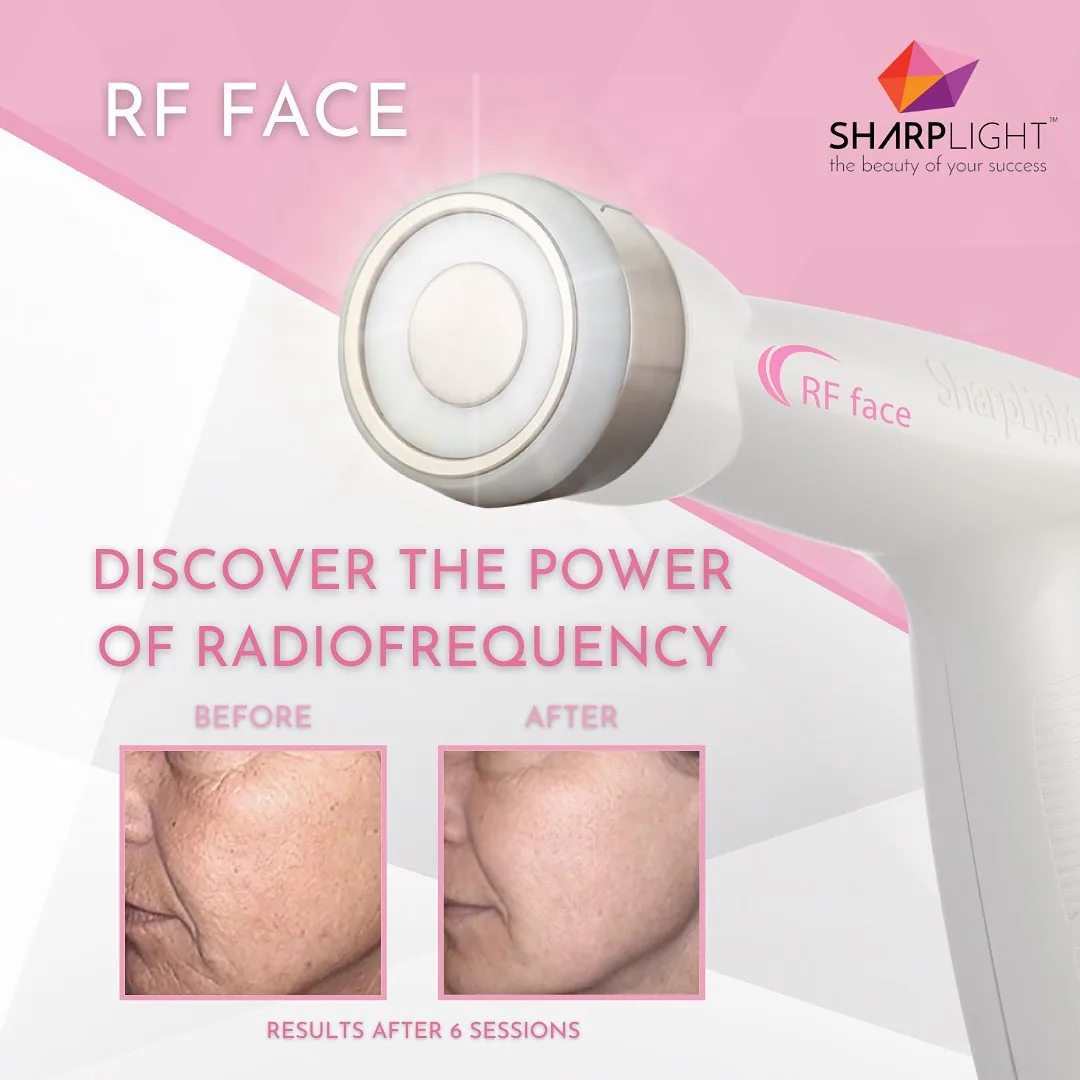 Radio frequency facial contouring treatment